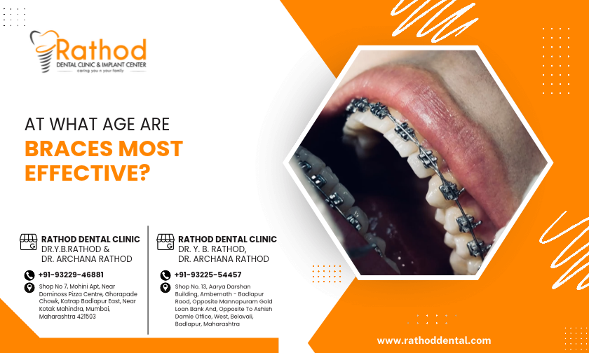 braces treatment near me