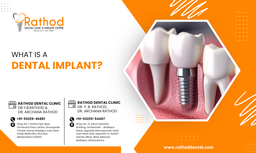 dental implant treatment near me