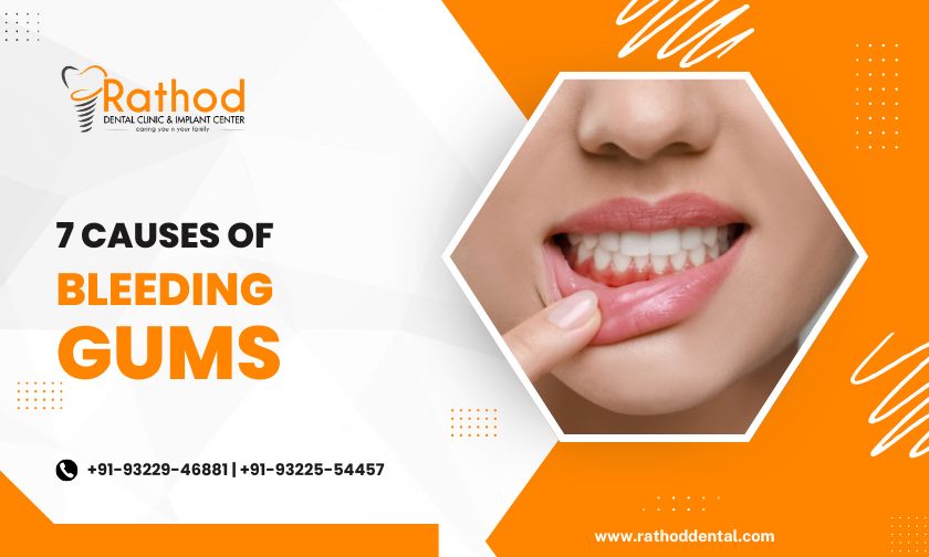 7 Causes of Bleeding Gums