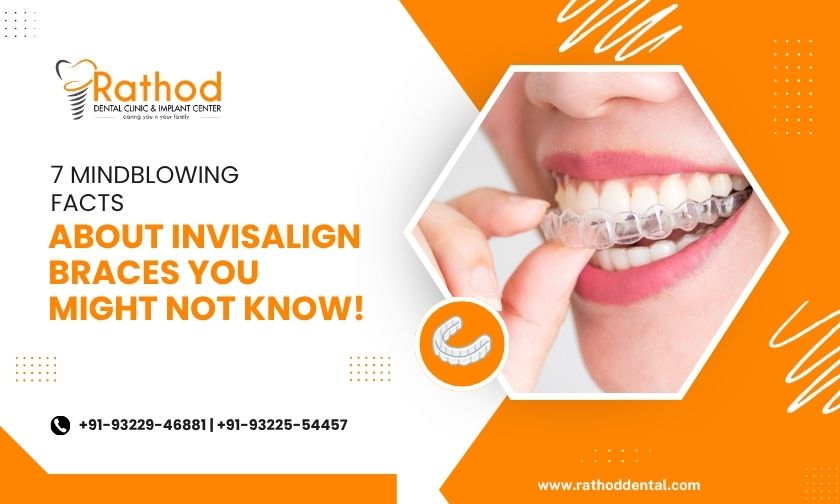 invisible braces treatment in badlapur