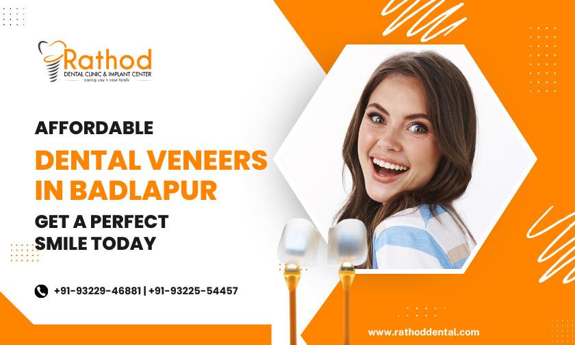 Affordable Dental Veneers in Badlapur Get a Perfect Smile Today