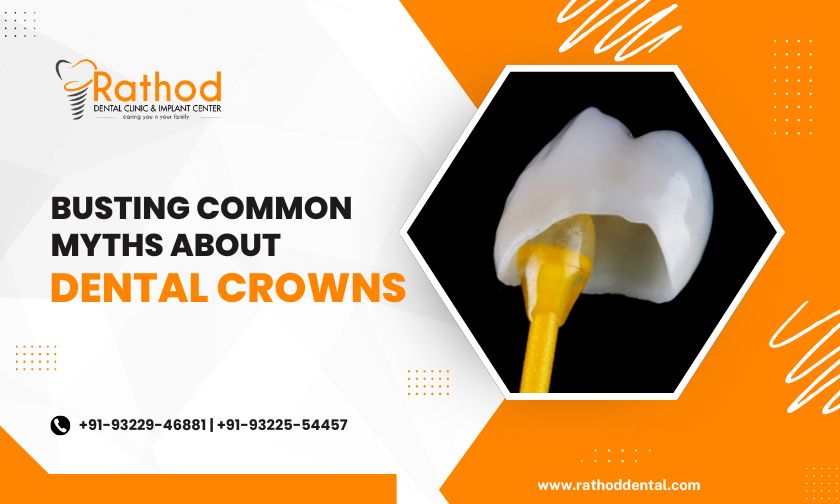 Ever heard someone say that dental crowns are only for the elderly or that they’ll never feel like your real teeth? If so, you’ve been fed a dental myth! Dental crowns are one of the most versatile solutions in modern dentistry, yet they’re surrounded by so many misconceptions. Let’s set the record straight and bust some of the most common myths about dental crowns. If you’re considering dental crown treatment in Badlapur, this blog will help you make an informed decision.  Myth 1: Dental Crowns Are Only for Older People Dental crowns aren’t age-specific. While they’re often used to restore teeth weakened by age, they’re also a great solution for anyone with damaged or decayed teeth. From teenagers with sports injuries to adults needing post-root canal protection, crowns are for everyone!  Why this matters: Dental crowns help protect and restore teeth regardless of age. So, if your dentist recommends one, it’s not about your age; it’s about your oral health.  Myth 2: Dental Crowns Look Fake A lot of people think crowns will stand out like a sore thumb, but that’s far from the truth. Today’s crowns are designed to blend seamlessly with your natural teeth. Dentists use materials like porcelain or ceramic that mimic the color and texture of real teeth.  Why this matters: A well-made crown is practically invisible! When you smile, no one will know which tooth has a crown—it’s your little secret.  Myth 3: Dental Crowns Are Painful to Get Does the idea of getting a crown make you cringe? Many people assume it’s a painful process, but it’s actually quite simple and comfortable. Dentists use local anesthesia to numb the area, so you won’t feel a thing during the procedure.  Why this matters: Modern techniques have made dental crown procedures quick and pain-free. If you’ve been holding back because of fear, it’s time to let go of that myth!  Myth 4: Crowns Don’t Last Long Some people believe crowns are temporary fixes, but with proper care, they can last 10 to 15 years or even longer. The key is maintaining good oral hygiene and avoiding habits like chewing on ice or biting your nails.  Why this matters: A crown is an investment in your dental health. Treat it well, and it will serve you for many years to come.  Myth 5: Crowns Make It Hard to Eat Another common myth is that eating becomes difficult with a crown. While it’s true that you might need to avoid hard or sticky foods for a short period after placement, a crown is designed to function just like a natural tooth.  Why this matters: Once your crown settles, you can enjoy your favorite foods without worry. Just remember to follow your dentist’s advice for care and maintenance.  Myth 6: Crowns Weaken the Natural Tooth Some people think that placing a crown involves removing most of the natural tooth. In reality, a crown protects and strengthens the tooth by covering it. Only the damaged or decayed parts of the tooth are removed before the crown is placed.  Why this matters: A crown doesn’t weaken your tooth—it saves it. If you’re looking into dental crown treatment in Badlapur, know that it’s a safe and effective solution.  Myth 7: Crowns Are Expensive and Not Worth It Yes, crowns can be an investment, but they’re absolutely worth it for the benefits they provide. A crown not only restores function but also improves the appearance of your smile. Plus, it prevents further damage, saving you money in the long run.  Why this matters: Think of a crown as a long-term solution rather than a one-time fix. It’s about preserving your dental health for years to come.  Dental crowns are a fantastic solution for restoring damaged teeth, but misconceptions often cloud their benefits. By understanding the truth, you can make better decisions for your oral health. If you’re considering dental crown treatment in Badlapur, consult a trusted dentist to learn more about how crowns can help you. Remember, a healthy smile is always worth it!