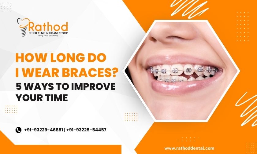 How Long Do I Wear Braces 5 Ways to Improve Your Time