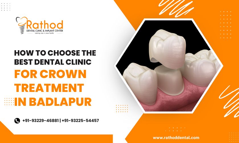 How to Choose the Best Dental Clinic for Crown Treatment in Badlapur