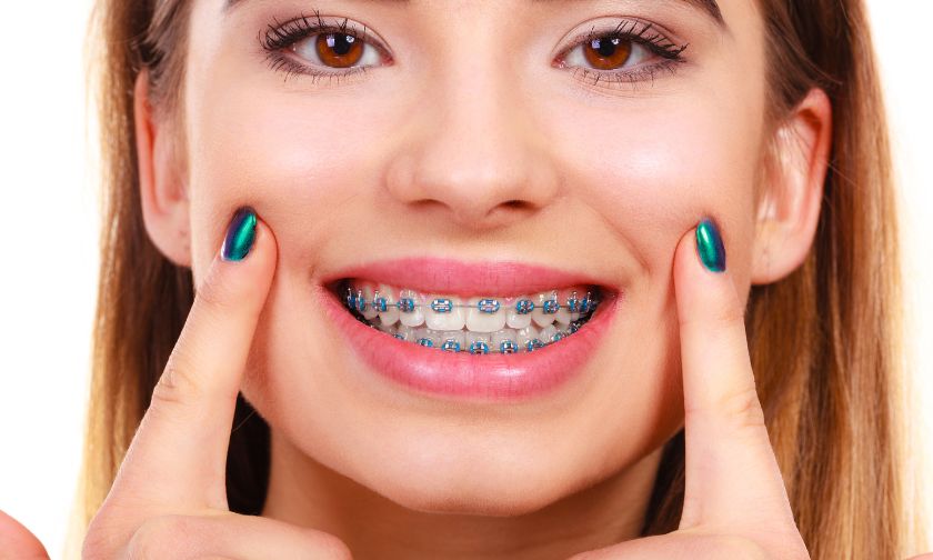 Keeping Your Smile Safe During Sports Essentials Braces Protection Tips