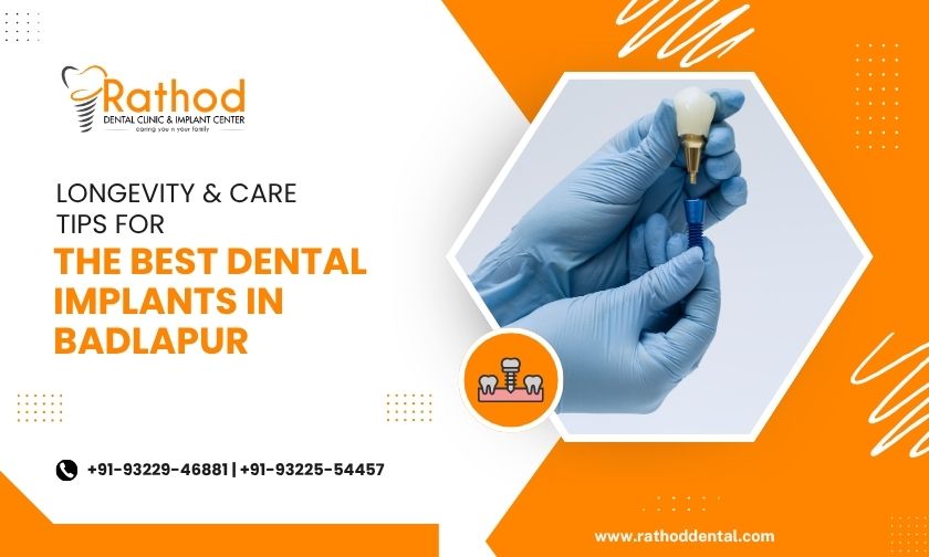 best dental implants in badlapur