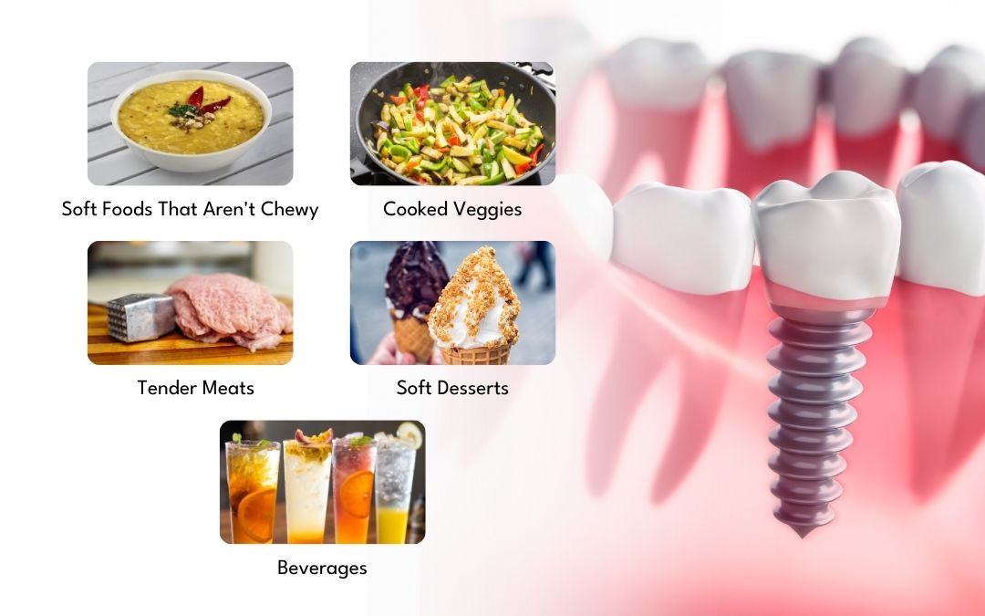 Safe Holiday Food Choices After Dental Implant Surgery