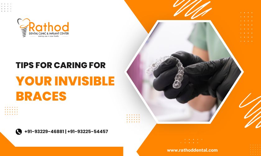 Tips For Caring For Your Invisible Braces