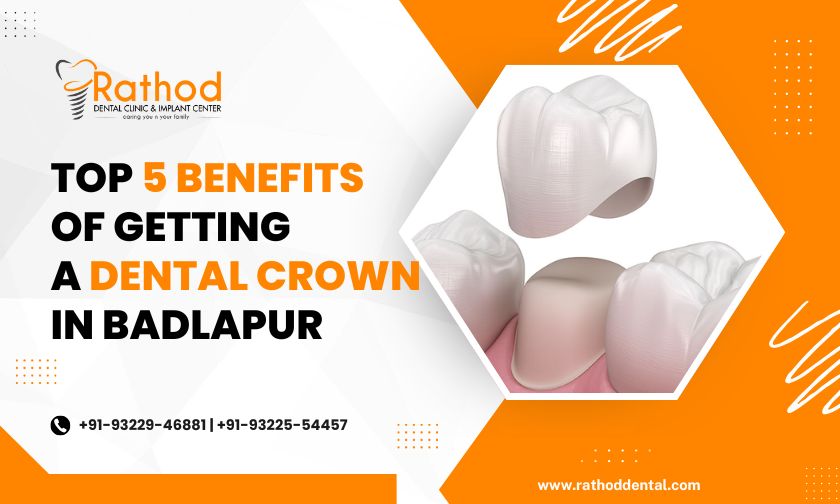 Top 5 Benefits of Getting a Dental Crown in Badlapur