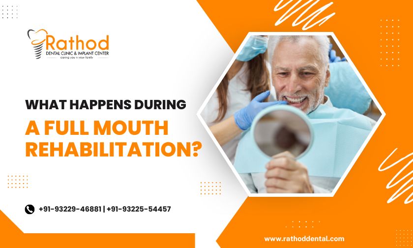 What Happens During A Full Mouth Rehabilitation