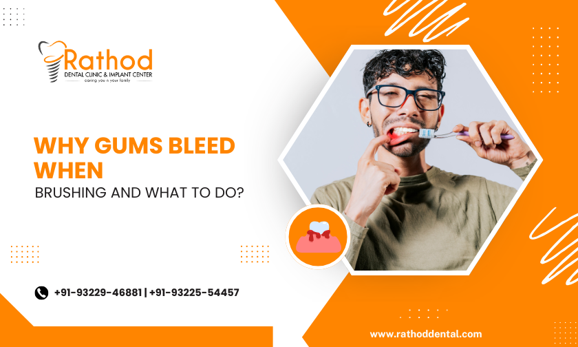 Why Gums Bleed When Brushing And What To Do?